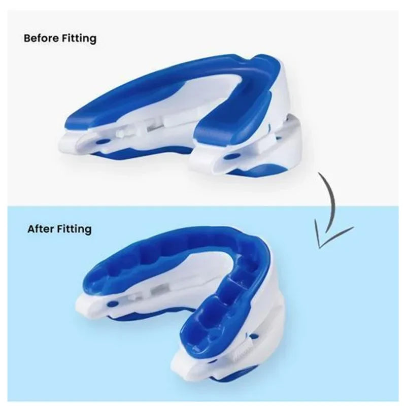 Anti-Snoring Adjustable Mouth Guard