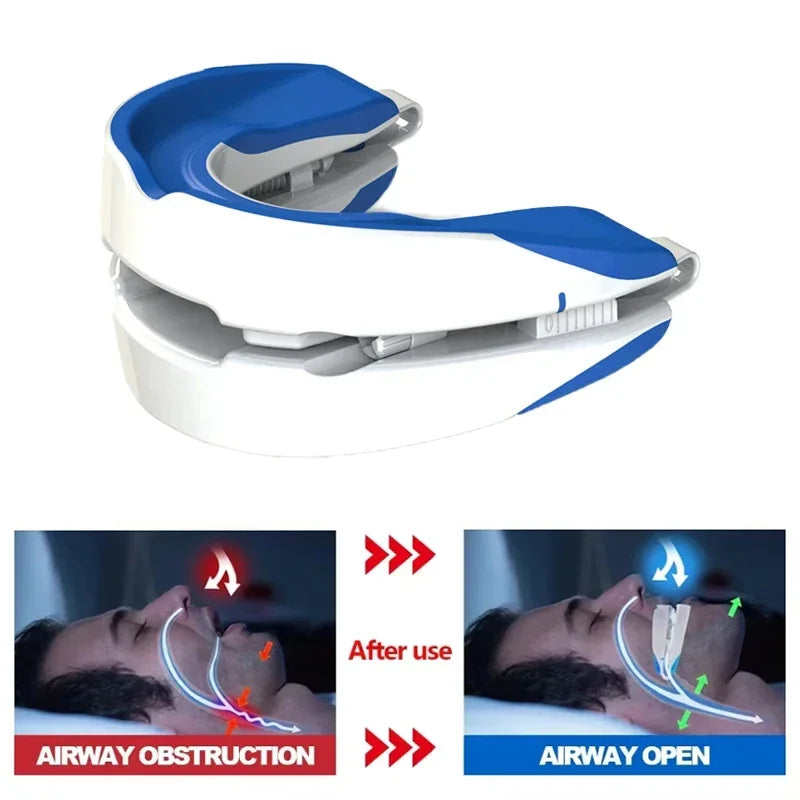 Anti-Snoring Adjustable Mouth Guard