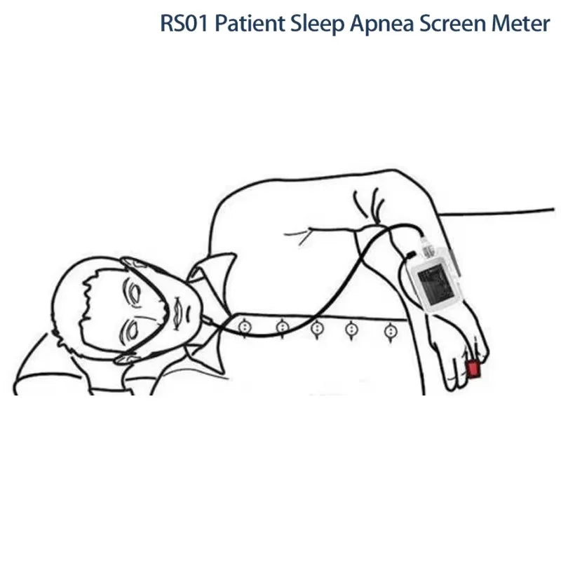 RS01 Sleep Apnea Monitor Device