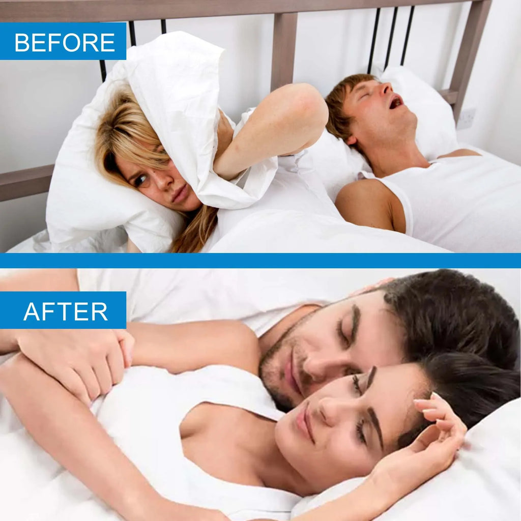 Anti-Snoring Mouth Tape Strips